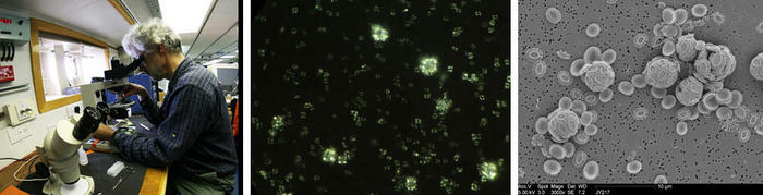 Left: Microscopy – Jeremy and his microscope are about the same age as the Discovery (the ship was launched in 1962) but still provide the fastest and most accurate means of determining the plankton population<br />Centre: The view down the microscope – a ‘cross polarised’ light image of E. huxleyi cells and coccoliths from yesterday morning<br />Right: Scanning electron microscope view – a similar assemblage (from a 2004 bloom in the Bay of Biscay) seen in an SEM. Electron microscopes provide much higher magnification but don’t work so well on ships rolling 10-15° either way in an Atlantic swell, so we will be doing SEM studies (including for signs of coccoliths dissolving) after the cruise